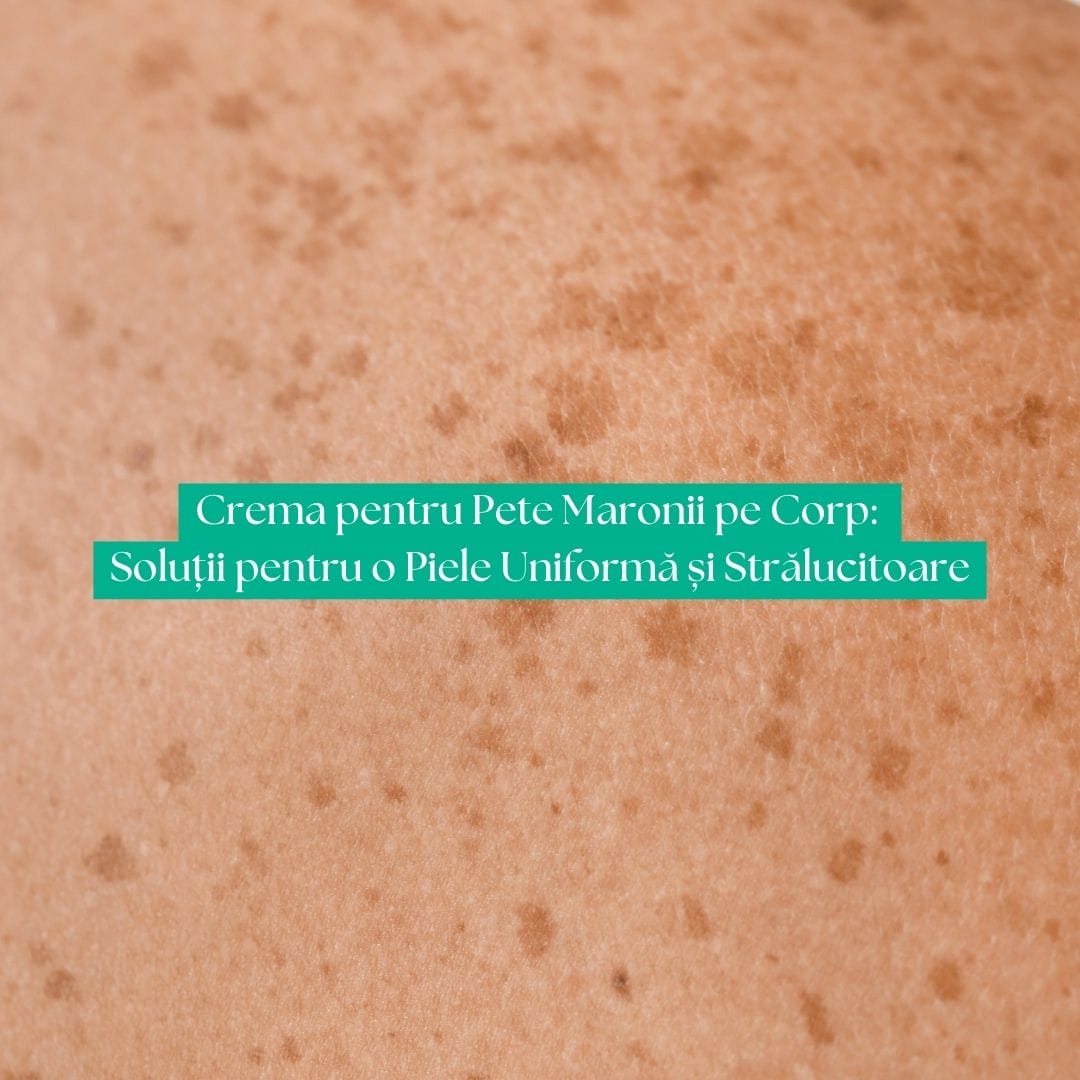 Crema pentru Pete Maronii pe Corp: Soluții pentru o Piele Uniformă și Strălucitoare